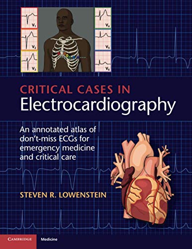 Critical Cases in Electrocardiography An Annotated Atlas of Don't-Miss ECGs for [Paperback]