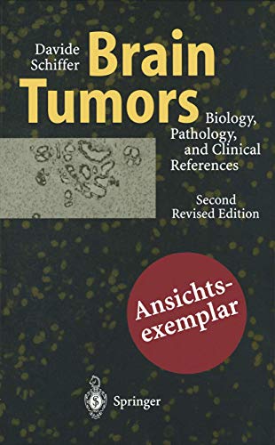 Brain Tumors Biology, Pathology and Clinical References [Paperback]