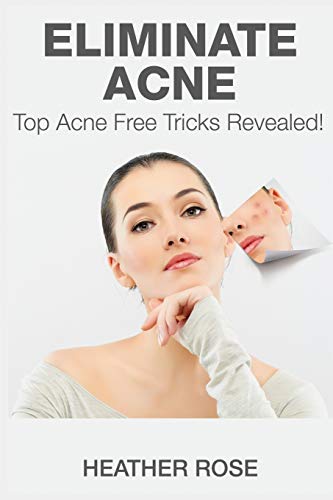 Eliminate Acne Top Acne Free Tricks Revealed [Paperback]