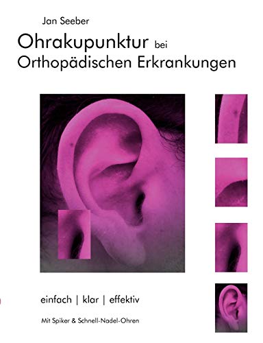 Ohrakupunktur Bei Orthopdischen Erkrankungen [Paperback]