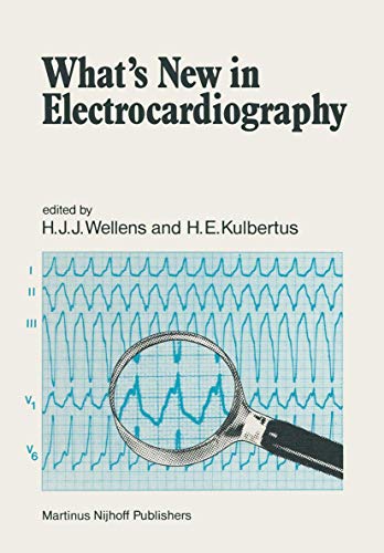 Whats New in Electrocardiography [Paperback]