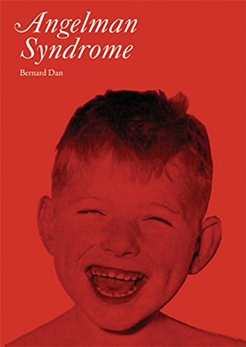 Angelman Syndrome [Paperback]