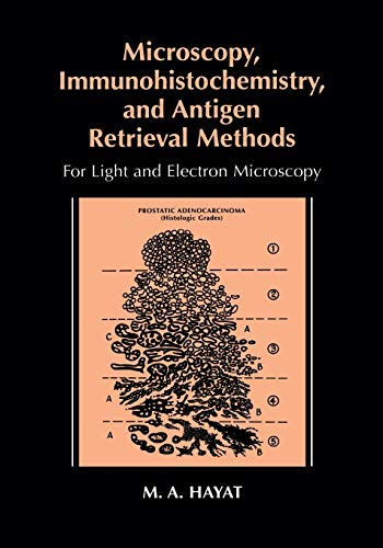Microscopy, Immunohistochemistry, and Antigen Retrieval Methods: For Light and E [Paperback]