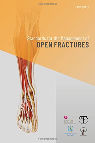 Standards for the Management of Open Fractures [Paperback]