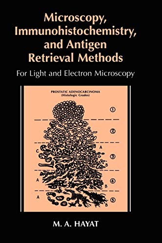 Microscopy, Immunohistochemistry, and Antigen Retrieval Methods: For Light and E [Hardcover]