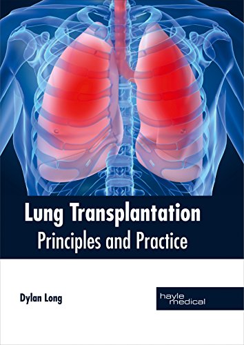 Lung Transplantation Principles And Practice [Hardcover]