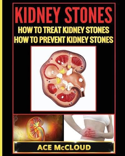 Kidney Stones How To Treat Kidney Stones How To Prevent Kidney Stones [Paperback]