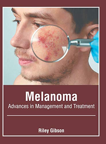 Melanoma Advances in Management and Treatment [Hardcover]