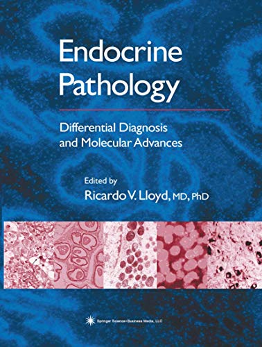 Endocrine Pathology Differential Diagnosis and Molecular Advances [Paperback]