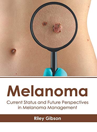 Melanoma Current Status and Future Perspectives in Melanoma Management [Hardcover]