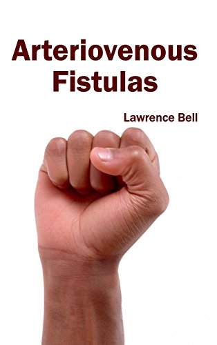 Arteriovenous Fistulas [Hardcover]
