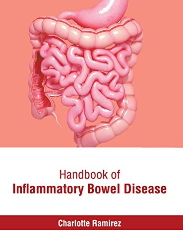 Handbook of Inflammatory Bowel Disease [Hardcover]
