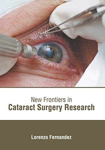 New Frontiers in Cataract Surgery Research [Hardcover]