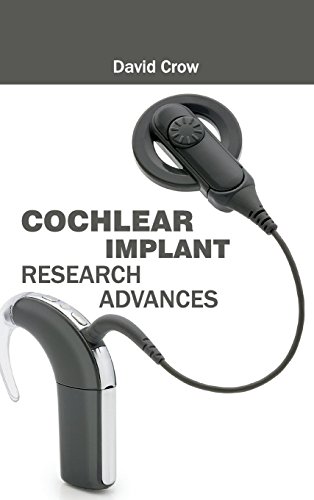 Cochlear Implant Research Advances [Hardcover]