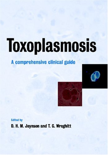 Toxoplasmosis A Comprehensive Clinical Guide [Paperback]