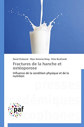 Fractures de la Hanche et Osteoporose [Paperback]
