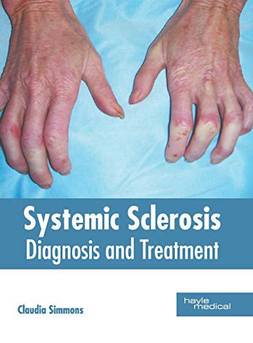 Systemic Sclerosis Diagnosis and Treatment [Hardcover]