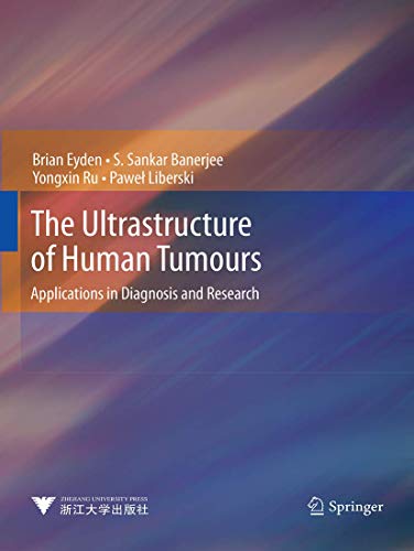 The Ultrastructure of Human Tumours Applications in Diagnosis and Research [Paperback]