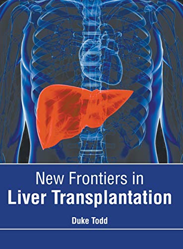 New Frontiers in Liver Transplantation [Hardcover]