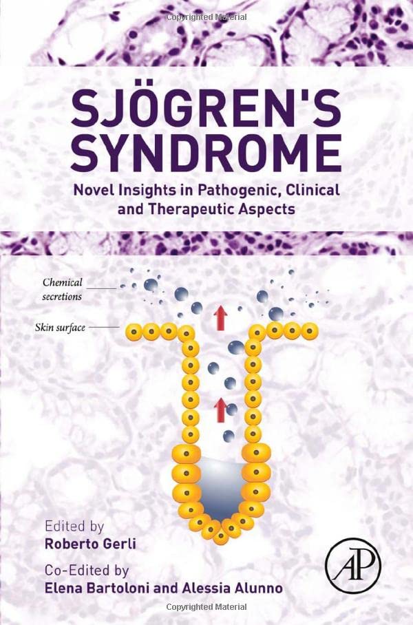Sjogren's Syndrome Novel Insights in Pathogenic, Clinical and Therapeutic Aspec [Hardcover]