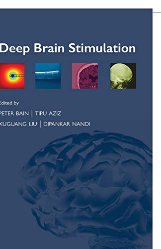 Deep Brain Stimulation [Paperback]
