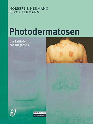 Photodermatosen Ein Leitfaden zur Diagnostik [Paperback]