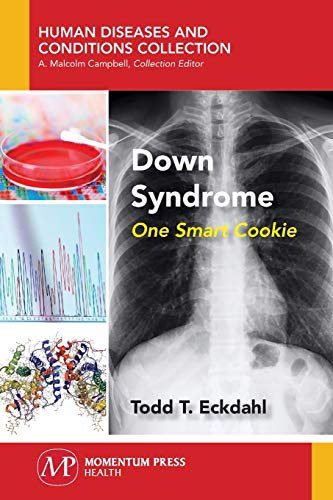 Down Syndrome The Amazing Cookie [Paperback]