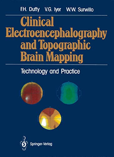 Clinical Electroencephalography and Topographic Brain Mapping Technology and Pr [Paperback]