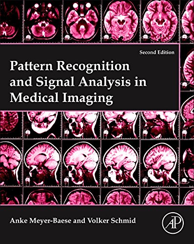 Pattern Recognition and Signal Analysis in Medical Imaging [Paperback]