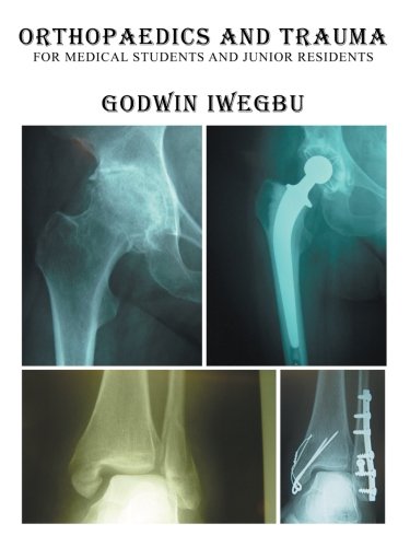 Orthopaedics and Trauma for Medical Students and Junior Residents [Paperback]