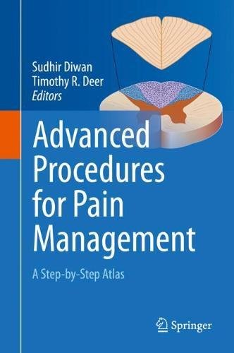 Advanced Procedures for Pain Management A Step-by-Step Atlas [Hardcover]