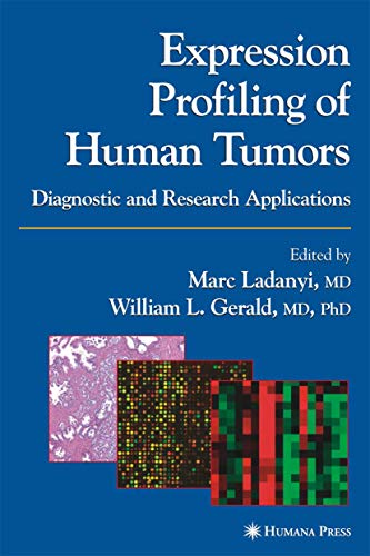 Expression Profiling of Human Tumors Diagnostic and Research Applications [Hardcover]