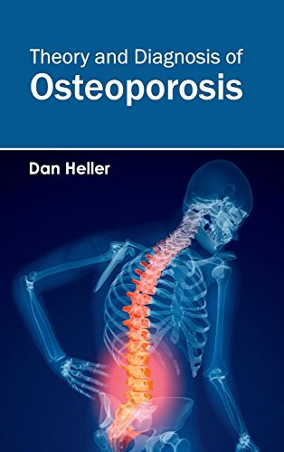 Theory And Diagnosis Of Osteoporosis [Hardcover]