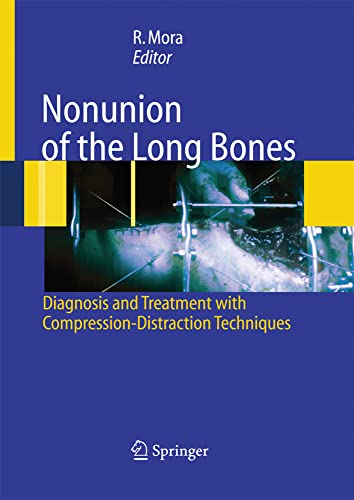 Nonunion of the Long Bones Diagnosis and treatment with compression-distraction [Paperback]