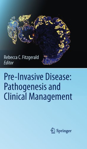 Pre-Invasive Disease Pathogenesis and Clinical Management [Paperback]