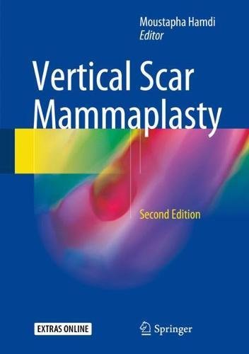 Vertical Scar Mammaplasty [Mixed media product]