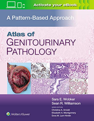 Atlas of Genitourinary Pathology A Pattern Based Approach [Hardcover]