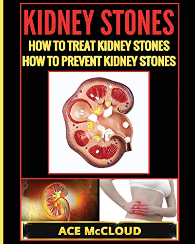 Kidney Stones How To Treat Kidney Stones How To Prevent Kidney Stones [Paperback]
