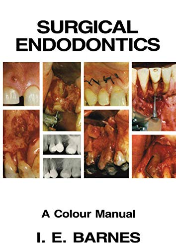 Surgical Endodontics A Colour Manual [Paperback]