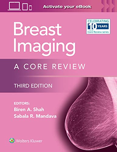 Breast Imaging A Core Review [Paperback]
