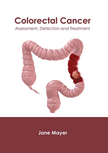 Colorectal Cancer Assessment, Detection and Treatment [Hardcover]