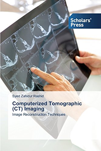 Computerized Tomographic (ct) Imaging [Paperback]