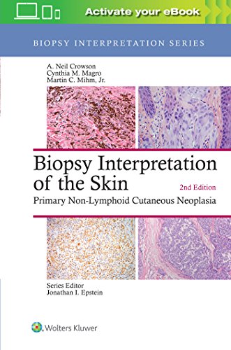 Biopsy Interpretation of the Skin Primary Non-Lymphoid Cutaneous Neoplasia [Hardcover]