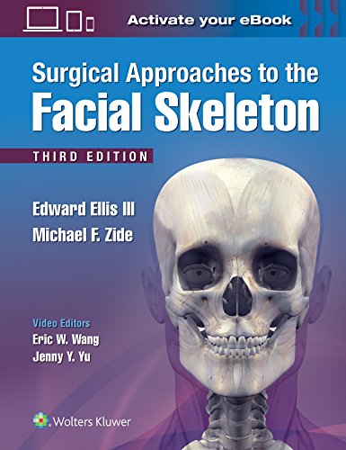 Surgical Approaches to the Facial Skeleton [Hardcover]