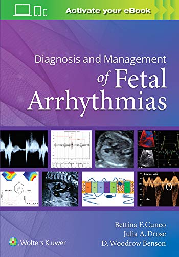 Diagnosis and Management of Fetal Arrhythmias [Paperback]