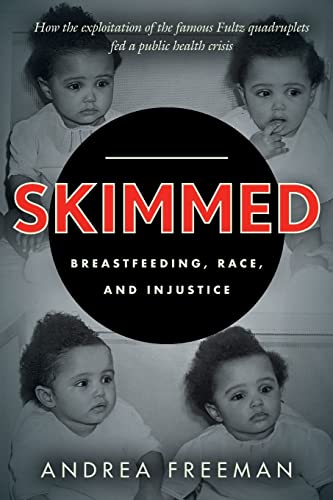 Skimmed Breastfeeding, Race, and Injustice [Paperback]