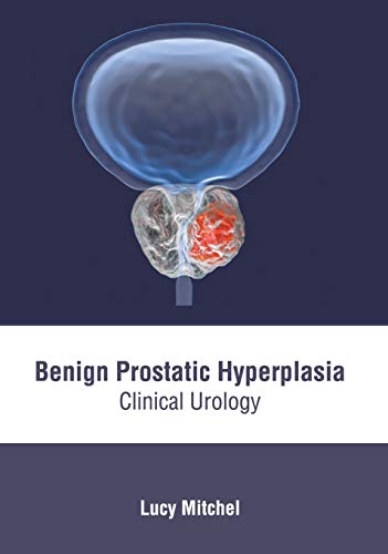 Benign Prostatic Hyperplasia Clinical Urology [Hardcover]