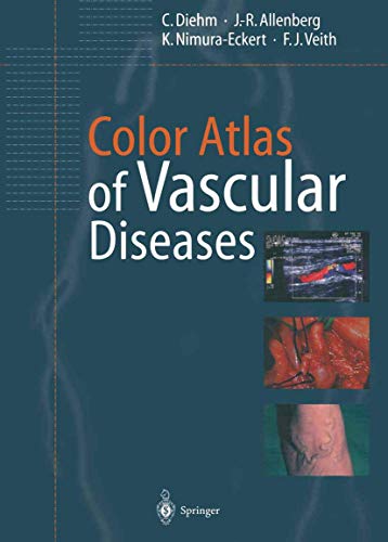 Color Atlas of Vascular Diseases [Paperback]