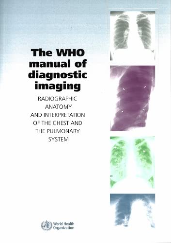 The WHO Manual of Diagnostic Imaging Radiographic Anatomy and Interpretation of [Paperback]
