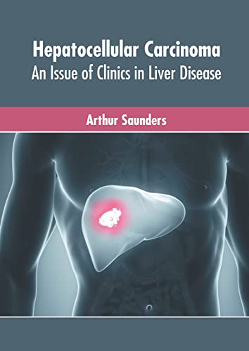 Hepatocellular Carcinoma An Issue Of Clinics In Liver Disease